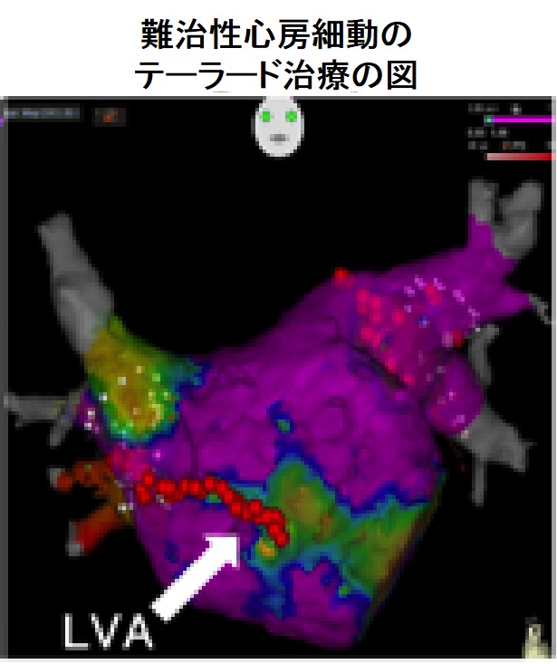 診療の特色 循環器内科 診療科 日本赤十字社 福岡赤十字病院