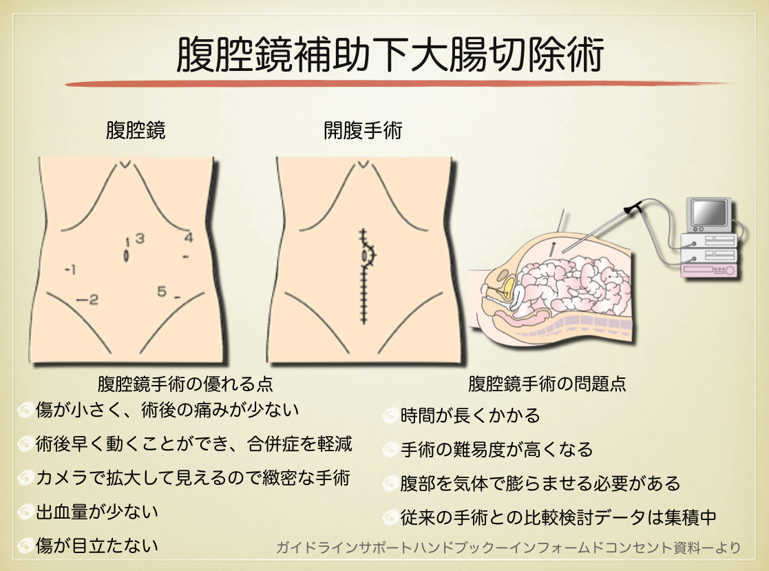 診療について｜外科系｜消化管外科｜診療科・専門外来｜日本